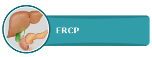 Endoscopic Retrogrde Cholangio-Pancretography (ERCP)