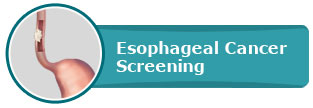 "Esophageal Cancer Screening Pacific- Gastroenterology Center for Digestive Health"
